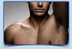 Men's Underarm laser hair removal McKinney Tx