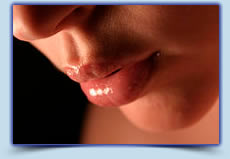 Upper lip laser hair removal treatment